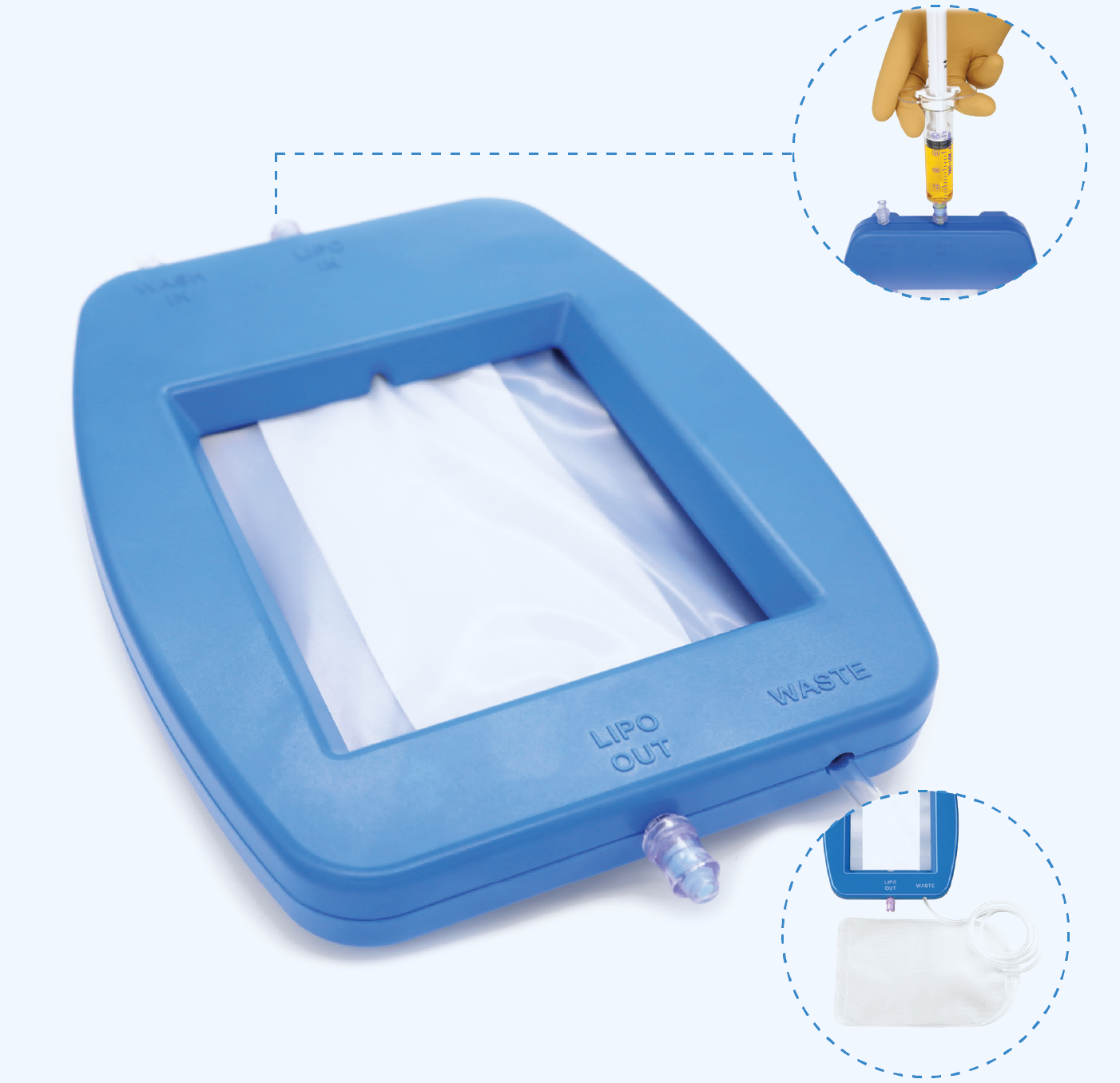 exafat, all-in-one fat dyalising system