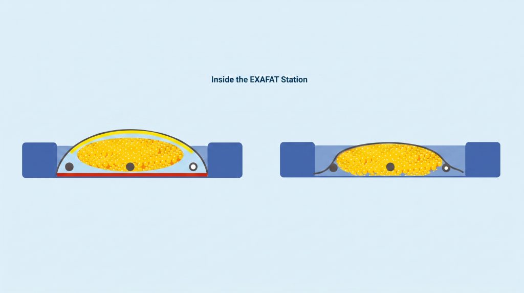 Fat Dialysis